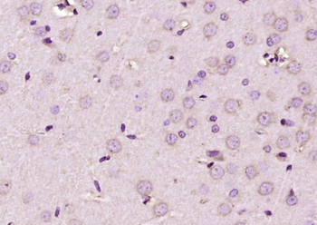 FXR2 Rabbit Polyclonal Antibody