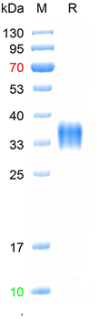 Recombinant human FOLR1 protein, C-His (HEK293)