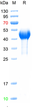 Recombinant human HER2 protein, N-His