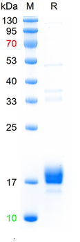 Recombinant human NPC2 protein, N-His