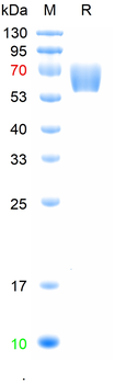 Recombinant human ROBO4 protein, C-His (HEK293)