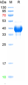 Recombinant human DMBT1 protein, C-His