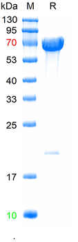 Recombinant human Osteopontin protein, C-His (HEK293)