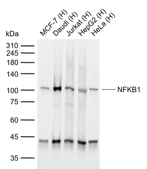 NFKB1 Recombinant Rabbit Monoclonal Antibody