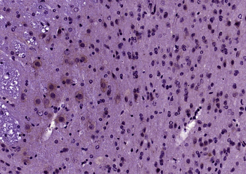 Proteasome 26S S2 Rabbit Polyclonal Antibody