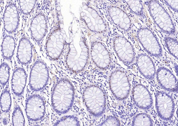 SOD1 Recombinant Rabbit Monoclonal Antibody