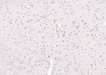 SOD1 Recombinant Rabbit Monoclonal Antibody