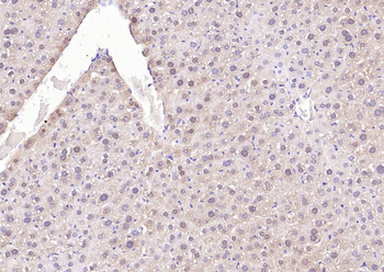 SOD1 Recombinant Rabbit Monoclonal Antibody