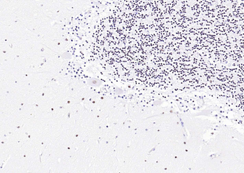 TARDBP Recombinant Rabbit Monoclonal Antibody
