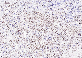 TARDBP Recombinant Rabbit Monoclonal Antibody