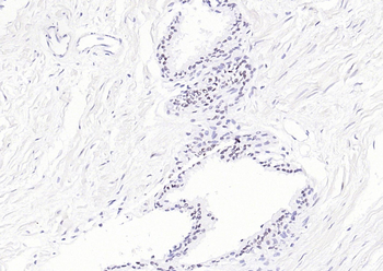 TARDBP Recombinant Rabbit Monoclonal Antibody