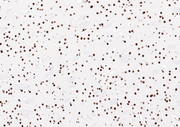 TARDBP Recombinant Rabbit Monoclonal Antibody