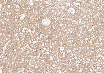 Tau Recombinant Rabbit Monoclonal Antibody