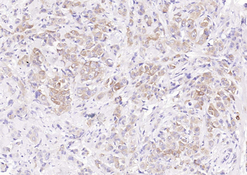 Tau Recombinant Rabbit Monoclonal Antibody