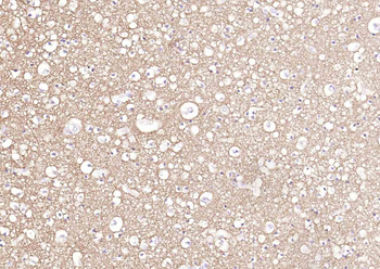 Synaptophysin Rabbit Polyclonal Antibody