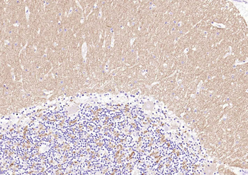 Synaptophysin Rabbit Polyclonal Antibody