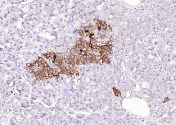 Synaptophysin Rabbit Polyclonal Antibody