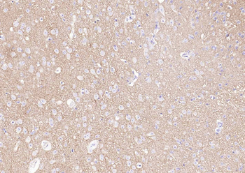 Synaptophysin Rabbit Polyclonal Antibody