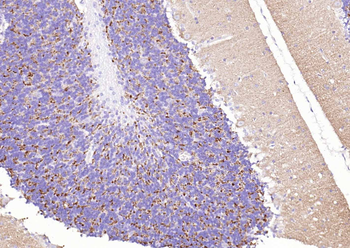 Synaptophysin Rabbit Polyclonal Antibody