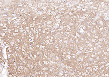 Synaptophysin Rabbit Polyclonal Antibody