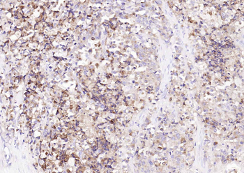 PAP Recombinant Rabbit Monoclonal Antibody