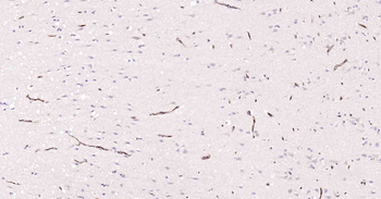 P Glycoprotein Recombinant Rabbit Monoclonal Antibody