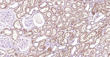 P Glycoprotein Recombinant Rabbit Monoclonal Antibody