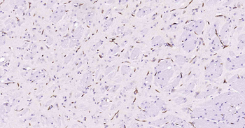 P Glycoprotein Recombinant Rabbit Monoclonal Antibody