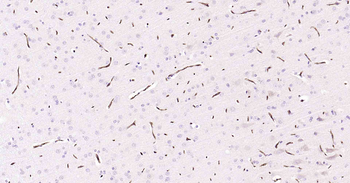 P Glycoprotein Recombinant Rabbit Monoclonal Antibody
