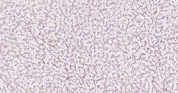 P Glycoprotein Recombinant Rabbit Monoclonal Antibody