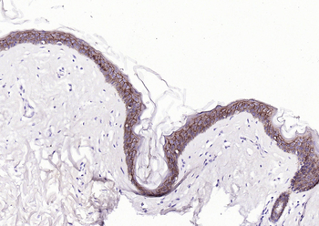E cadherin Recombinant Rabbit Monoclonal Antibody