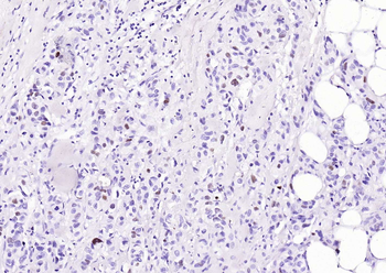 P53 Recombinant Rabbit Monoclonal Antibody