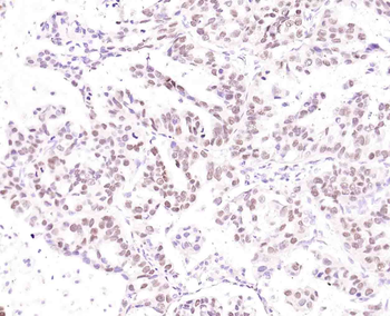 P53 Recombinant Rabbit Monoclonal Antibody