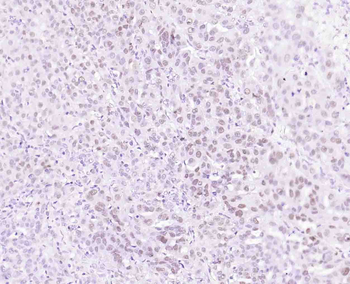 P53 Recombinant Rabbit Monoclonal Antibody