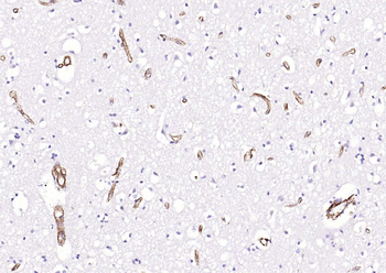 Caveolin-1 Recombinant Rabbit Monoclonal Antibody