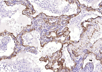 Caveolin-1 Recombinant Rabbit Monoclonal Antibody