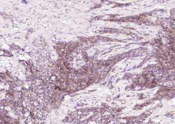 EpCAM Recombinant Rabbit Monoclonal Antibody