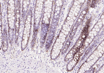 EpCAM Recombinant Rabbit Monoclonal Antibody