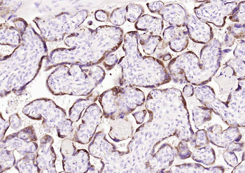 Placental Lactogen Recombinant Rabbit Monoclonal Antibody