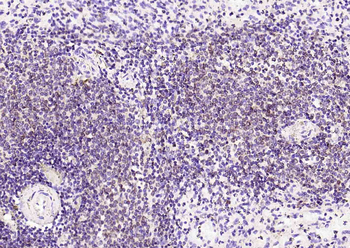 CD74 Recombinant Rabbit Monoclonal Antibody