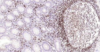 CD79A Recombinant Rabbit Monoclonal Antibody