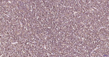 CD79A Recombinant Rabbit Monoclonal Antibody