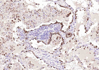 NAPSIN A Mouse Monoclonal Antibody