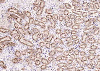 NAPSIN A Mouse Monoclonal Antibody