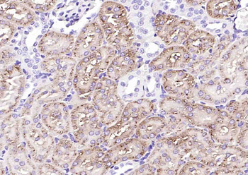 NAPSIN A Mouse Monoclonal Antibody