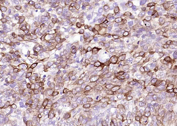 Cytokeratin 14 Mouse Monoclonal Antibody