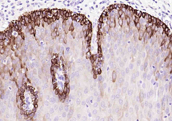 Cytokeratin 14 Mouse Monoclonal Antibody