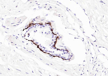 Cytokeratin 14 Mouse Monoclonal Antibody