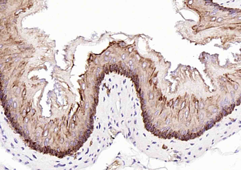 Cytokeratin 14 Mouse Monoclonal Antibody