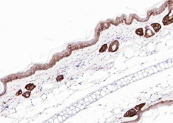 Cytokeratin 14 Mouse Monoclonal Antibody